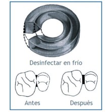 Separadores Molares Sep-A-Rings -100 unid-