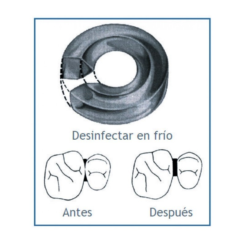 Separadores Molares Sep-A-Rings -100 unid-